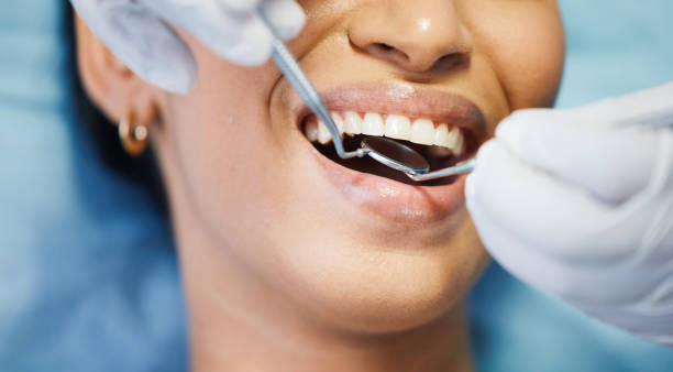 Best Emergency Treatment for Dental Infections or Abscesses in Rincon, GA